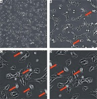 https://www.archivesofmedicalscience.com/f/fulltexts/73919/AMS-15-34942-g003_min.jpg