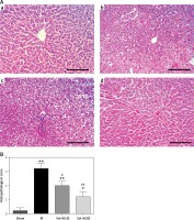 https://www.archivesofmedicalscience.com/f/fulltexts/73980/AMS-15-37460-g002_min.jpg