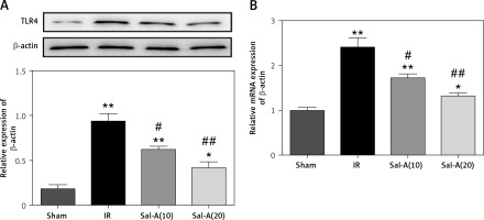 https://www.archivesofmedicalscience.com/f/fulltexts/73980/AMS-15-37460-g007_min.jpg