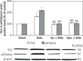 https://www.archivesofmedicalscience.com/f/fulltexts/74301/AMS-15-37405-g002_min.jpg