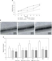 https://www.archivesofmedicalscience.com/f/fulltexts/74433/AMS-15-37895-g005_min.jpg