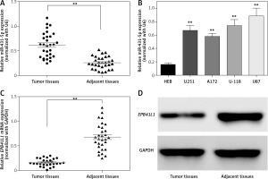 https://www.archivesofmedicalscience.com/f/fulltexts/74757/AMS-15-37835-g001_min.jpg