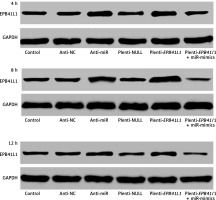 https://www.archivesofmedicalscience.com/f/fulltexts/74757/AMS-15-37835-g003_min.jpg