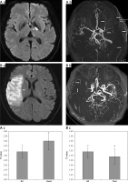 https://www.archivesofmedicalscience.com/f/fulltexts/75999/AMS-16-39437-g002_min.jpg