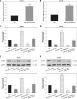 https://www.archivesofmedicalscience.com/f/fulltexts/76891/AMS-16-2-39464-g003_min.jpg