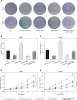 https://www.archivesofmedicalscience.com/f/fulltexts/76891/AMS-16-2-39464-g004_min.jpg