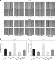 https://www.archivesofmedicalscience.com/f/fulltexts/76891/AMS-16-2-39464-g005_min.jpg