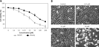 https://www.archivesofmedicalscience.com/f/fulltexts/76892/AMS-16-2-30995-g001_min.jpg