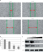 https://www.archivesofmedicalscience.com/f/fulltexts/76892/AMS-16-2-30995-g006_min.jpg