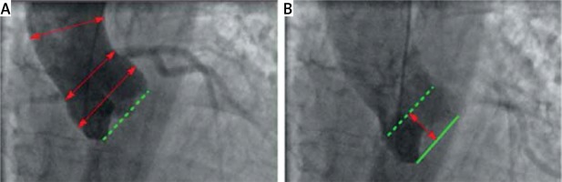 https://www.archivesofmedicalscience.com/f/fulltexts/79905/AMS-17-1-79905-g001_min.jpg