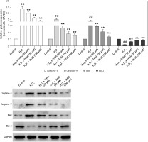 https://www.archivesofmedicalscience.com/f/fulltexts/80618/AMS-15-34247-g005_min.jpg