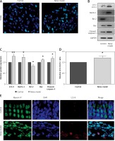 https://www.archivesofmedicalscience.com/f/fulltexts/80768/AMS-17-2-80768-g002_min.jpg