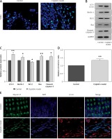 https://www.archivesofmedicalscience.com/f/fulltexts/80768/AMS-17-2-80768-g003_min.jpg