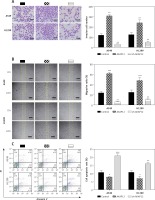 https://www.archivesofmedicalscience.com/f/fulltexts/80934/AMS-17-2-80934-g003_min.jpg