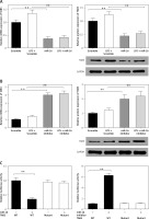 https://www.archivesofmedicalscience.com/f/fulltexts/80948/AMS-17-2-80948-g005_min.jpg