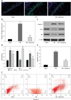 https://www.archivesofmedicalscience.com/f/fulltexts/80978/AMS-17-2-80978-g004_min.jpg