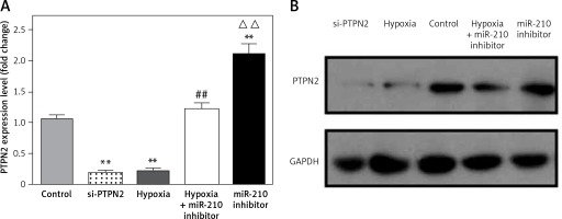 https://www.archivesofmedicalscience.com/f/fulltexts/81389/AMS-15-31622-g003_min.jpg