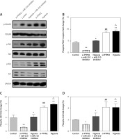 https://www.archivesofmedicalscience.com/f/fulltexts/81389/AMS-15-31622-g005_min.jpg