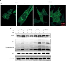 https://www.archivesofmedicalscience.com/f/fulltexts/81571/AMS-15-31986-g004_min.jpg