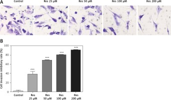 https://www.archivesofmedicalscience.com/f/fulltexts/82375/AMS-17-1-82375-g003_min.jpg