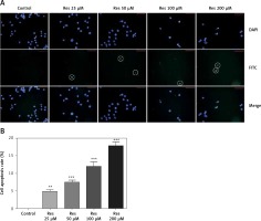 https://www.archivesofmedicalscience.com/f/fulltexts/82375/AMS-17-1-82375-g004_min.jpg