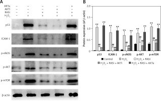 https://www.archivesofmedicalscience.com/f/fulltexts/82972/AMS-15-32083-g003_min.jpg