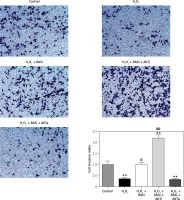 https://www.archivesofmedicalscience.com/f/fulltexts/82972/AMS-15-32083-g008_min.jpg