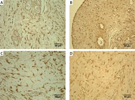 https://www.archivesofmedicalscience.com/f/fulltexts/87061/AMS-17-1-87061-g002_min.jpg