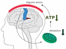 https://www.archivesofmedicalscience.com/f/fulltexts/89785/AMS-15-36990-g003_min.jpg