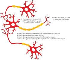 https://www.archivesofmedicalscience.com/f/fulltexts/90672/AMS-16-2-33217-g001_min.jpg