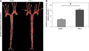 https://www.archivesofmedicalscience.com/f/fulltexts/91876/AMS-15-34572-g003_min.jpg