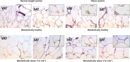 https://www.archivesofmedicalscience.com/f/fulltexts/92118/AMS-17-2-92118-g003_min.jpg