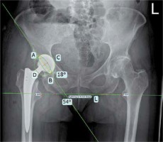 https://www.archivesofmedicalscience.com/f/fulltexts/92214/AMS-18-1-92214-g002_min.jpg