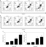 https://www.archivesofmedicalscience.com/f/fulltexts/92345/AMS-15-33291-g002_min.jpg