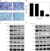 https://www.archivesofmedicalscience.com/f/fulltexts/92345/AMS-15-33291-g003_min.jpg