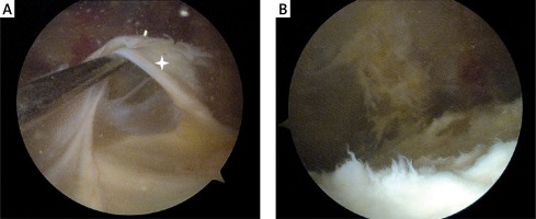 https://www.archivesofmedicalscience.com/f/fulltexts/93614/AMS-15-33524-g002_min.jpg