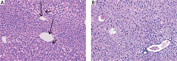 https://www.archivesofmedicalscience.com/f/fulltexts/94429/AMS-17-1-94429-g003_min.jpg