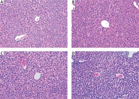 https://www.archivesofmedicalscience.com/f/fulltexts/94429/AMS-17-1-94429-g004_min.jpg