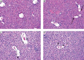 https://www.archivesofmedicalscience.com/f/fulltexts/94429/AMS-17-1-94429-g006_min.jpg