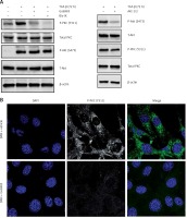 https://www.archivesofmedicalscience.com/f/fulltexts/94495/AMS-15-34078-g002_min.jpg