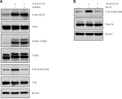 https://www.archivesofmedicalscience.com/f/fulltexts/94495/AMS-15-34078-g003_min.jpg