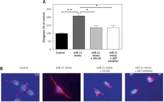 https://www.archivesofmedicalscience.com/f/fulltexts/94747/AMS-15-33940-g003_min.jpg