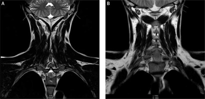 https://www.archivesofmedicalscience.com/f/fulltexts/97321/AMS-16-6-35773-g001_min.jpg