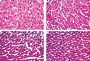 https://www.archivesofmedicalscience.com/f/fulltexts/99247/AMS-16-34276-g003_min.jpg