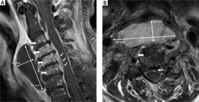 https://www.archivesofmedicalscience.com/f/fulltexts/99547/AMS-16-6-37256-g001_min.jpg