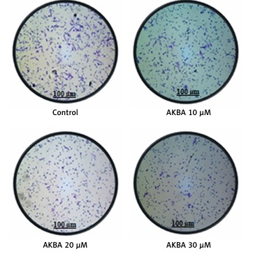 Figure from article: 3-Acetyl-11-keto-β-boswell...