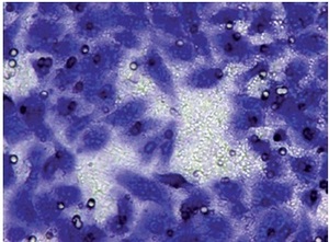 Figure from article: Allicin suppressed bladder...