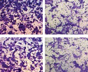 Figure from article: Circular RNA circ_0001421...