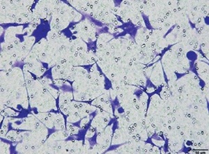 Figure from article: Nur77 knock-down suppresses...