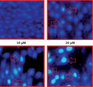Figure from article: Camelliol C inhibits...